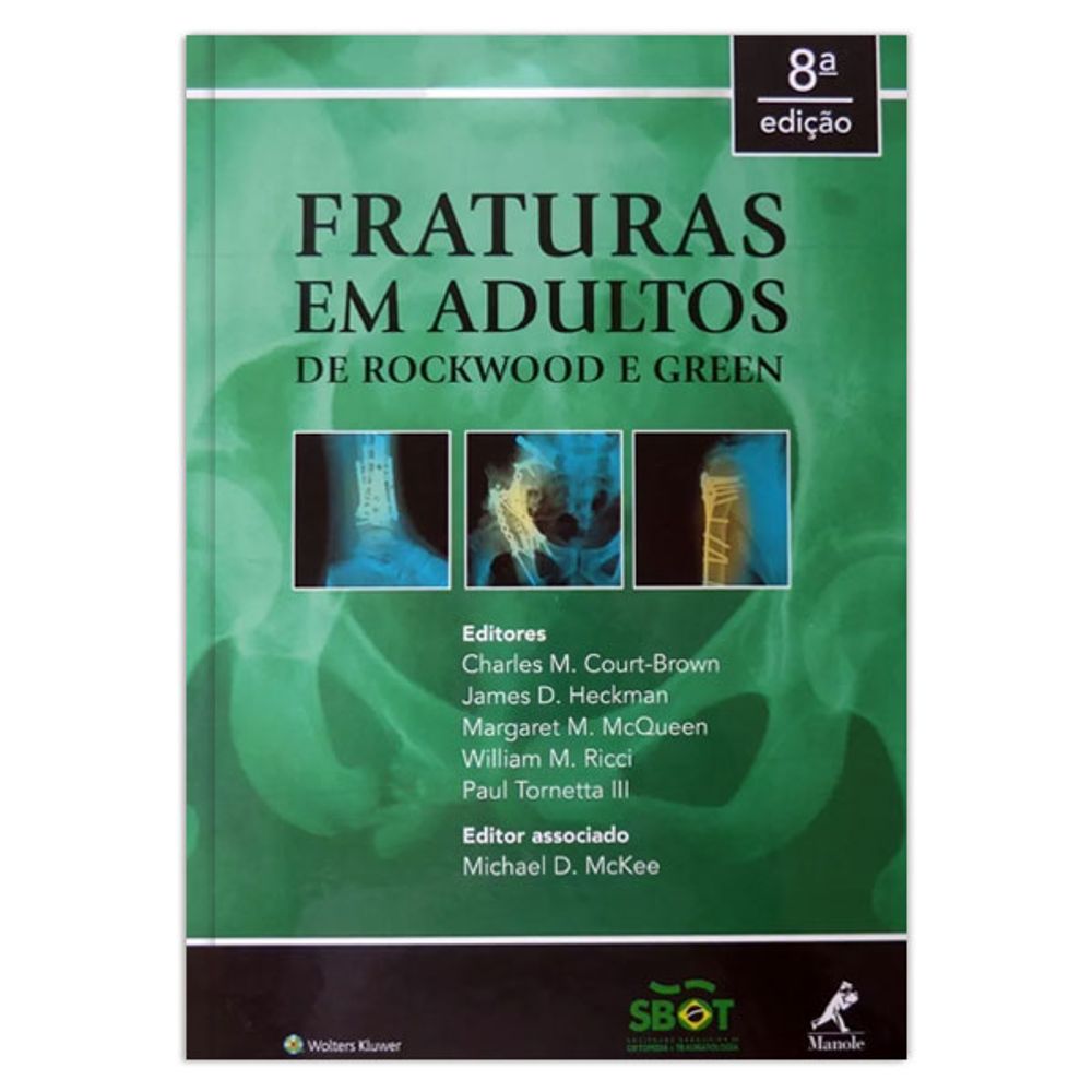 fraturas-em-adultos-de-rockwood-e-green-2-volumes-8-edicao