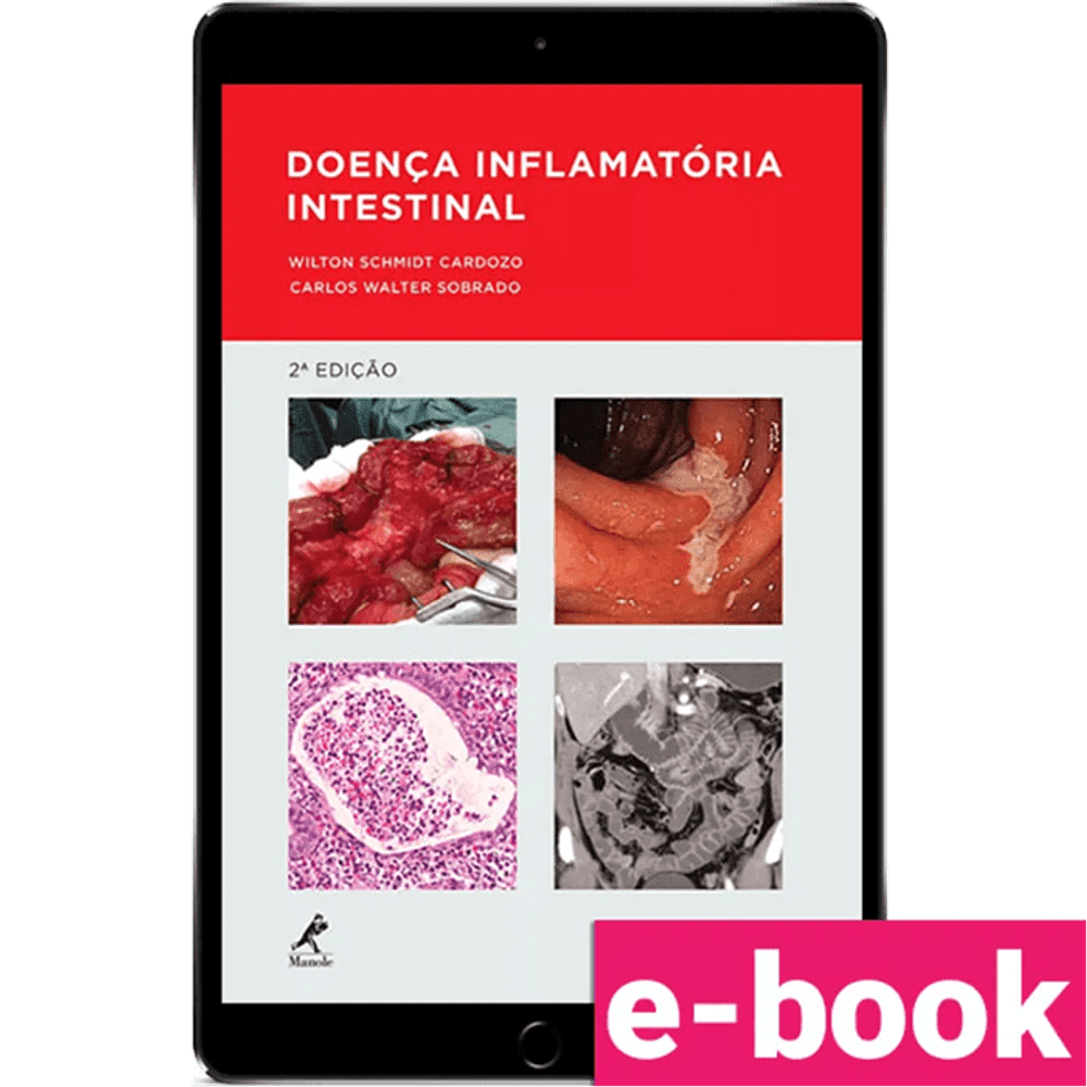 Doenca-inflamatoria-intestinal-2º-edicao