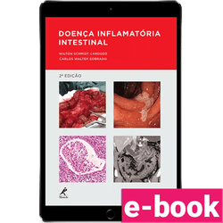 Doenca-inflamatoria-intestinal-2º-edicao