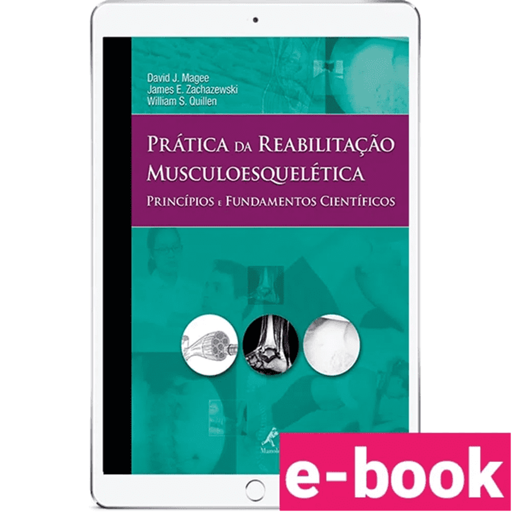 pratica-da-reabilitacao-musculoesqueletica-principios-e-fundamentos-cientificos-1º-edicao_optimized.png