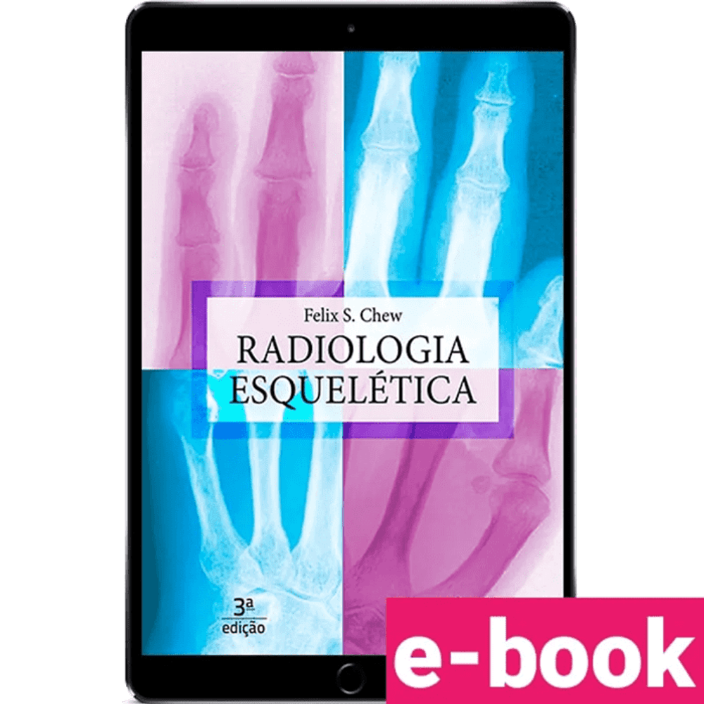 radiologia-esqueletica-3º-edicao_optimized.png