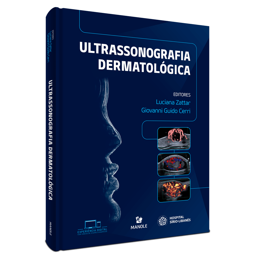 Ultrassonografia_Dermatologica