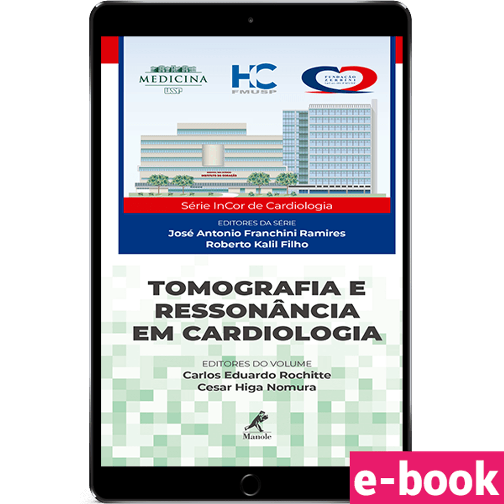 TOMOGRAFIA-E-RESSONANCIA-EM-CARDIOLOGIA
