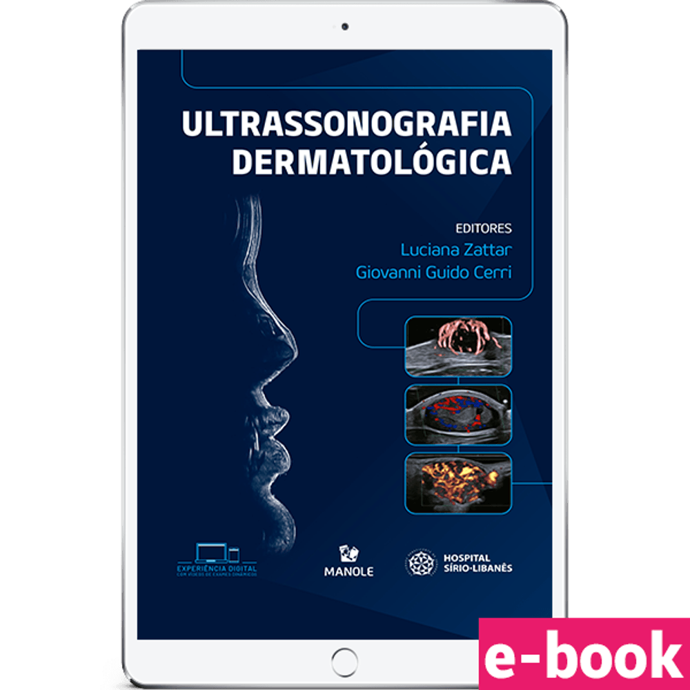 Ultrassonografia-Dermatologica